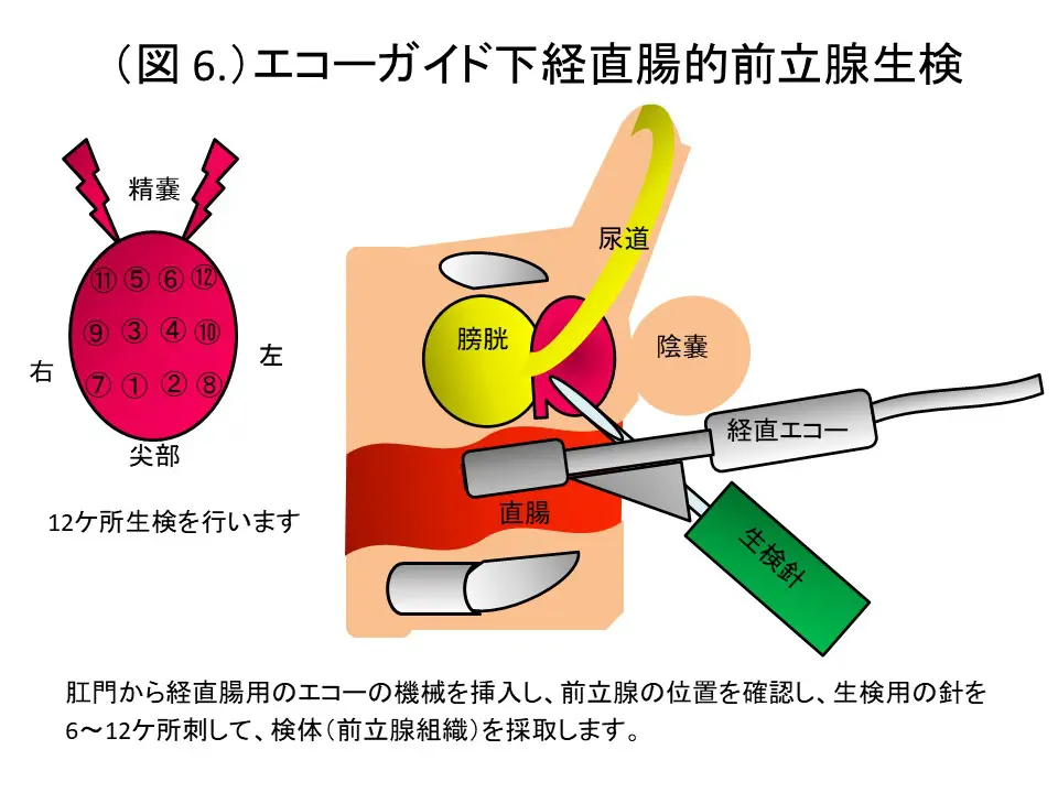 泌尿器科 | 小張総合病院